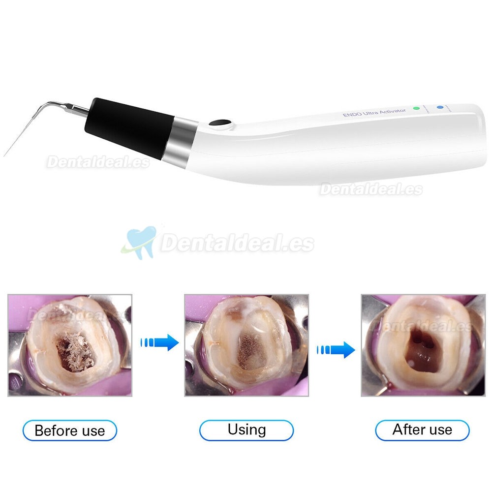 Cordless Ultrasonic Dental Endo Ultra Activator Handpiece 300° Irrigator Pen CE